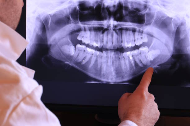 Best Emergency Gum Pain Relief  in Fort Campbell North, KY